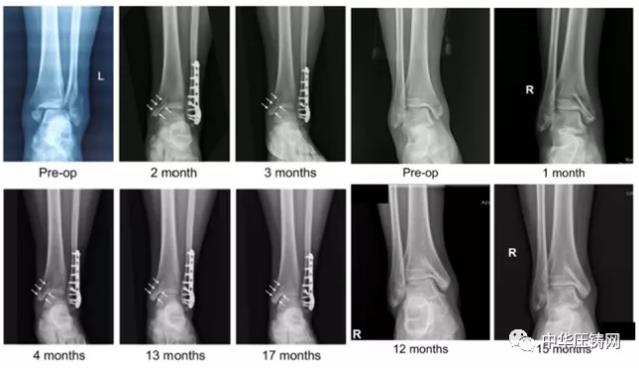 【特訊】銀光鎂業擬新增40臺鎂合金精密加工生產線；博格華納將為日產汽車供應分動箱；德威科技開年簽訂國際鎂輪轂生產訂單